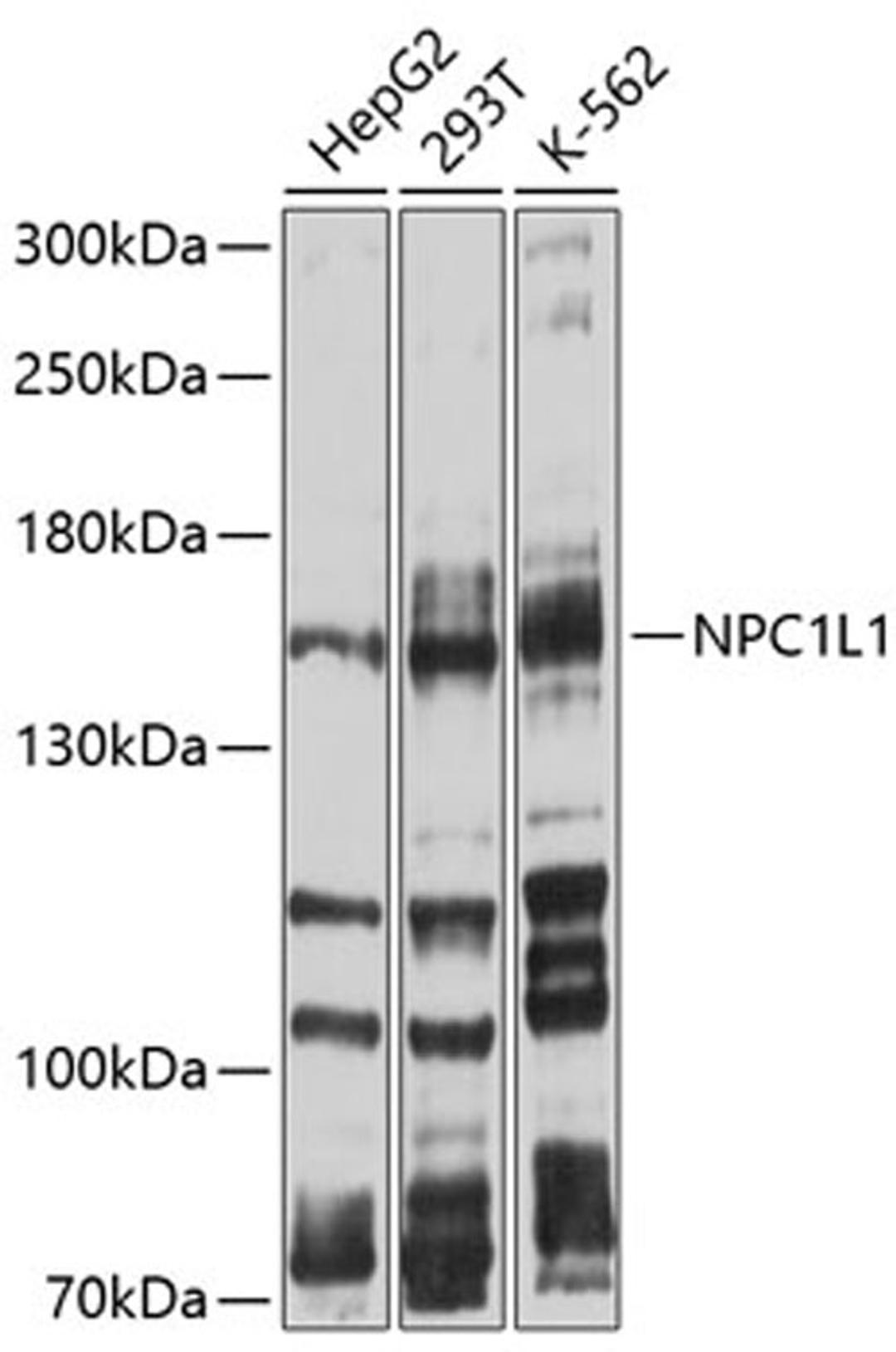 Western blot - NPC1L1 antibody (A10049)