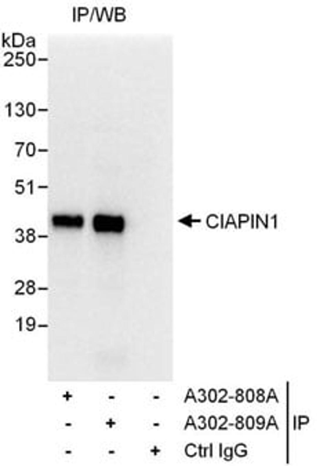 Detection of human CIAPIN1 by western blot of immunoprecipitates.