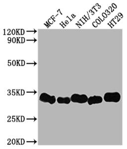 Western Blot. Positive WB detected in: MCF-7 whole cell lysate, Hela whole cell lysate, NIH/3T3 whole cell lysate, Colo320 whole cell lysate, HT29 whole cell lysate. All lanes: Galectin 3 antibody at 1:2000. Secondary. Goat polyclonal to rabbit IgG at 1/50000 dilution. Predicted band size: 27 kDa. Observed band size: 31 kDa. 