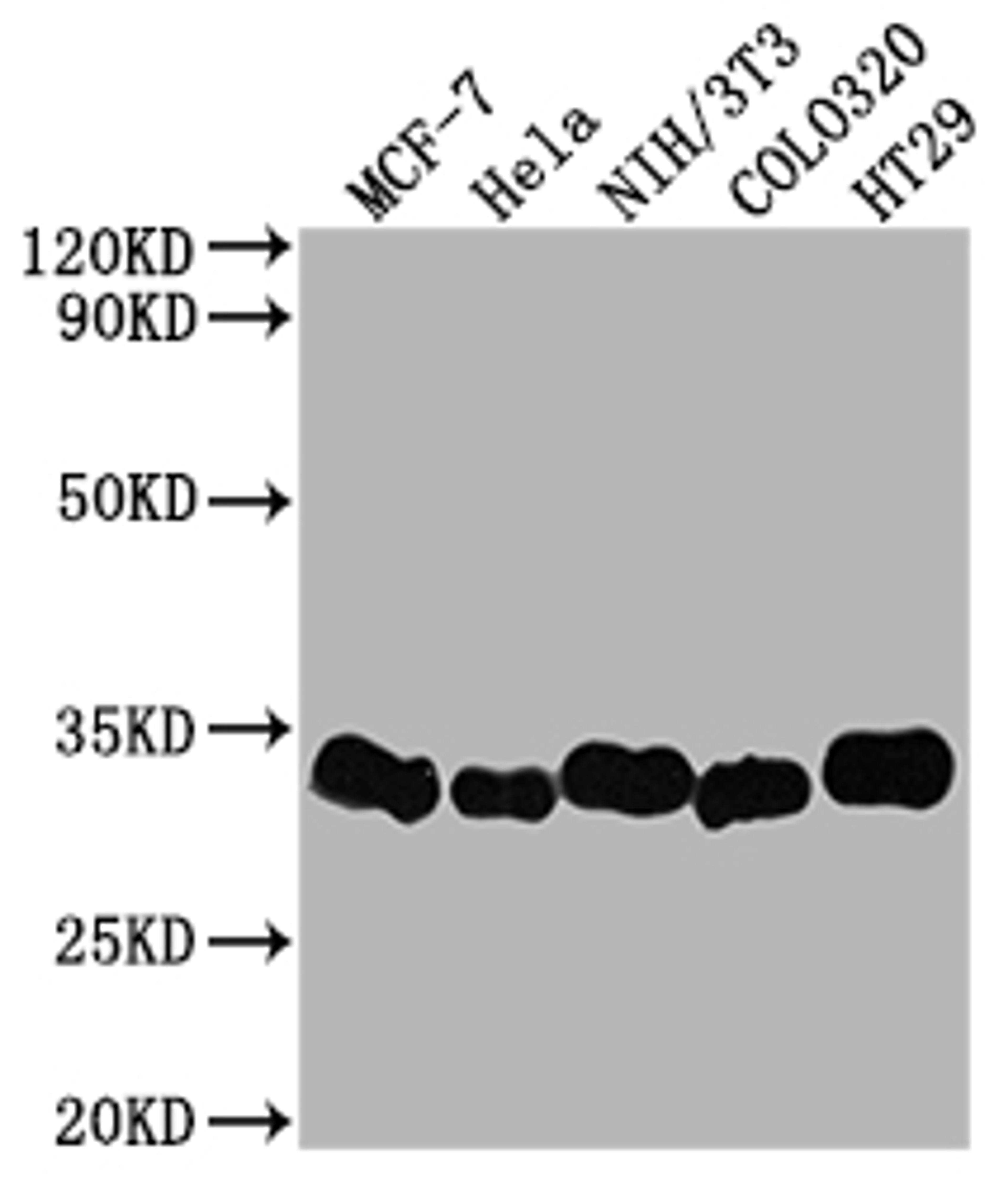 Western Blot. Positive WB detected in: MCF-7 whole cell lysate, Hela whole cell lysate, NIH/3T3 whole cell lysate, Colo320 whole cell lysate, HT29 whole cell lysate. All lanes: Galectin 3 antibody at 1:2000. Secondary. Goat polyclonal to rabbit IgG at 1/50000 dilution. Predicted band size: 27 kDa. Observed band size: 31 kDa. 