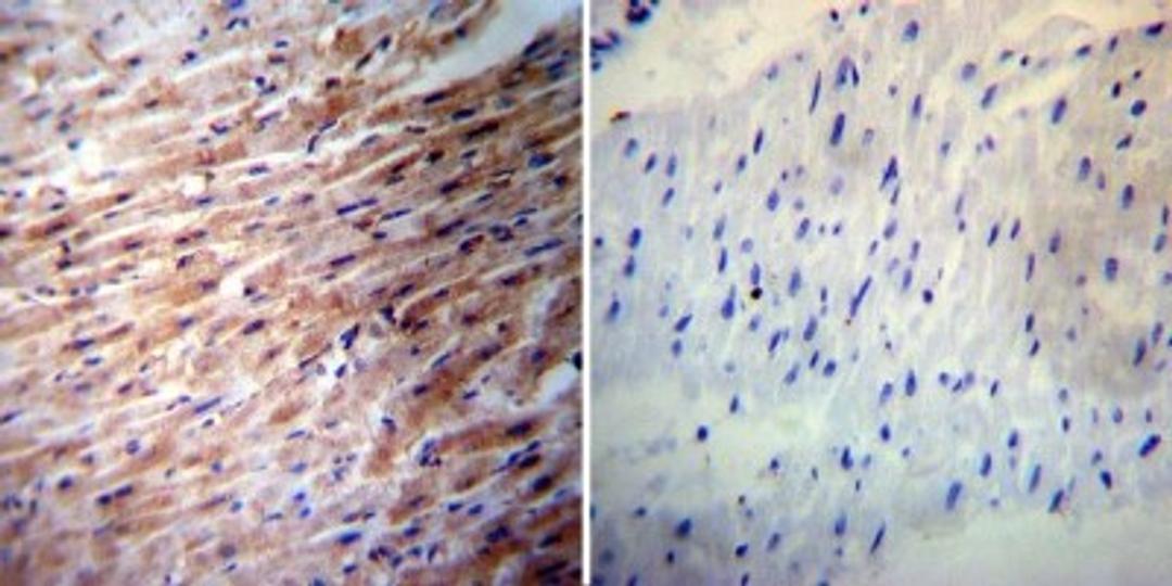 Immunohistochemistry-Paraffin: iNOS Antibody [NB300-605] - Both normal and cancer biopsies of deparaffinized human Heart tissue.