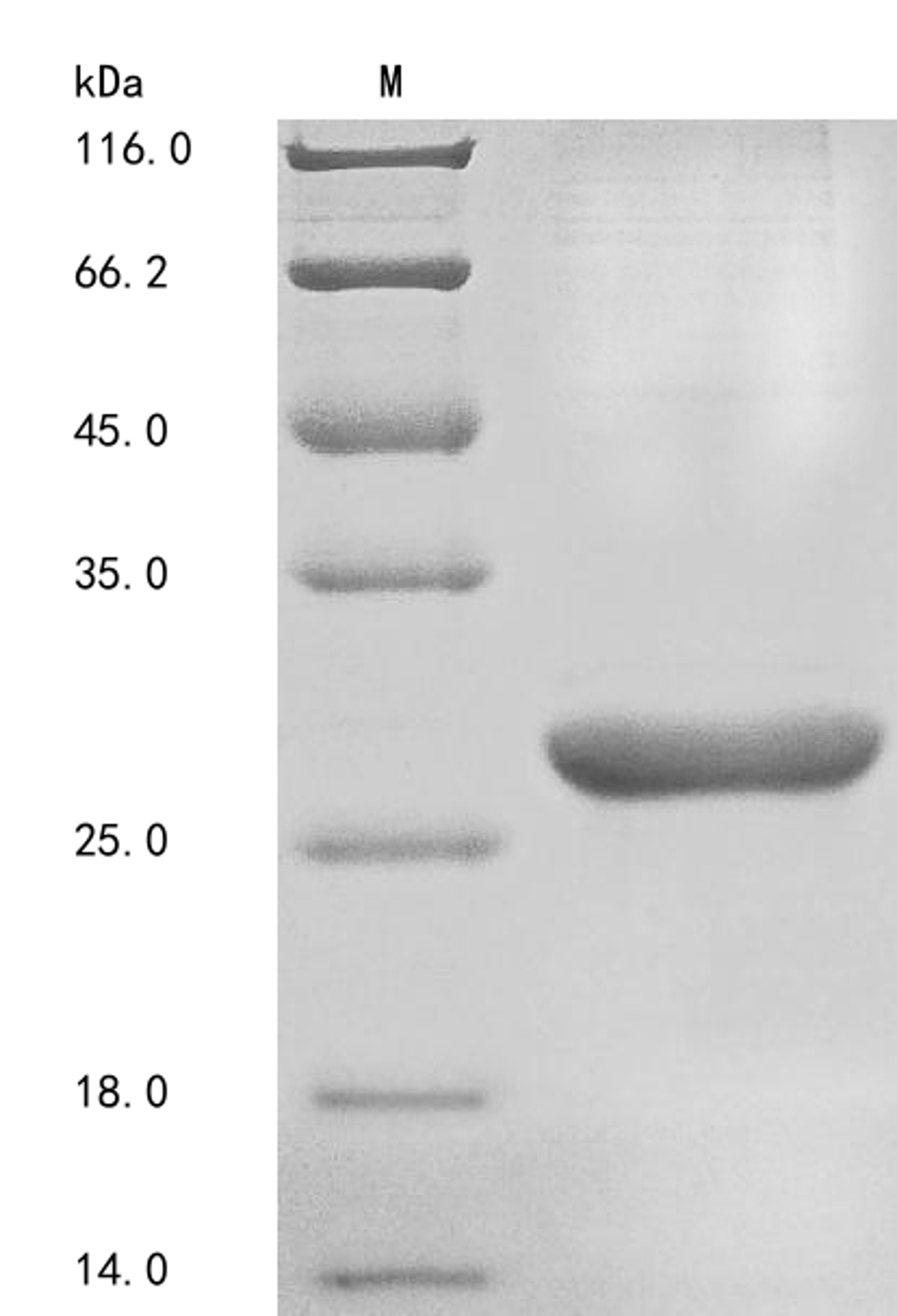 (Tris-Glycine gel) Discontinuous SDS-PAGE (reduced) with 5% enrichment gel and 15% separation gel.