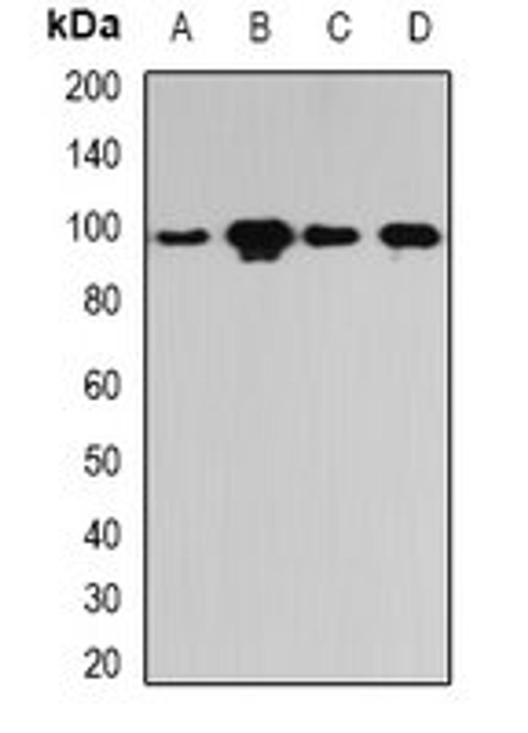 Western blot analysis of Hela (Lane1), SKOV3 (Lane2), mouse lung (Lane3), rat liver (Lane4) whole cell lysates using PYGL antibody