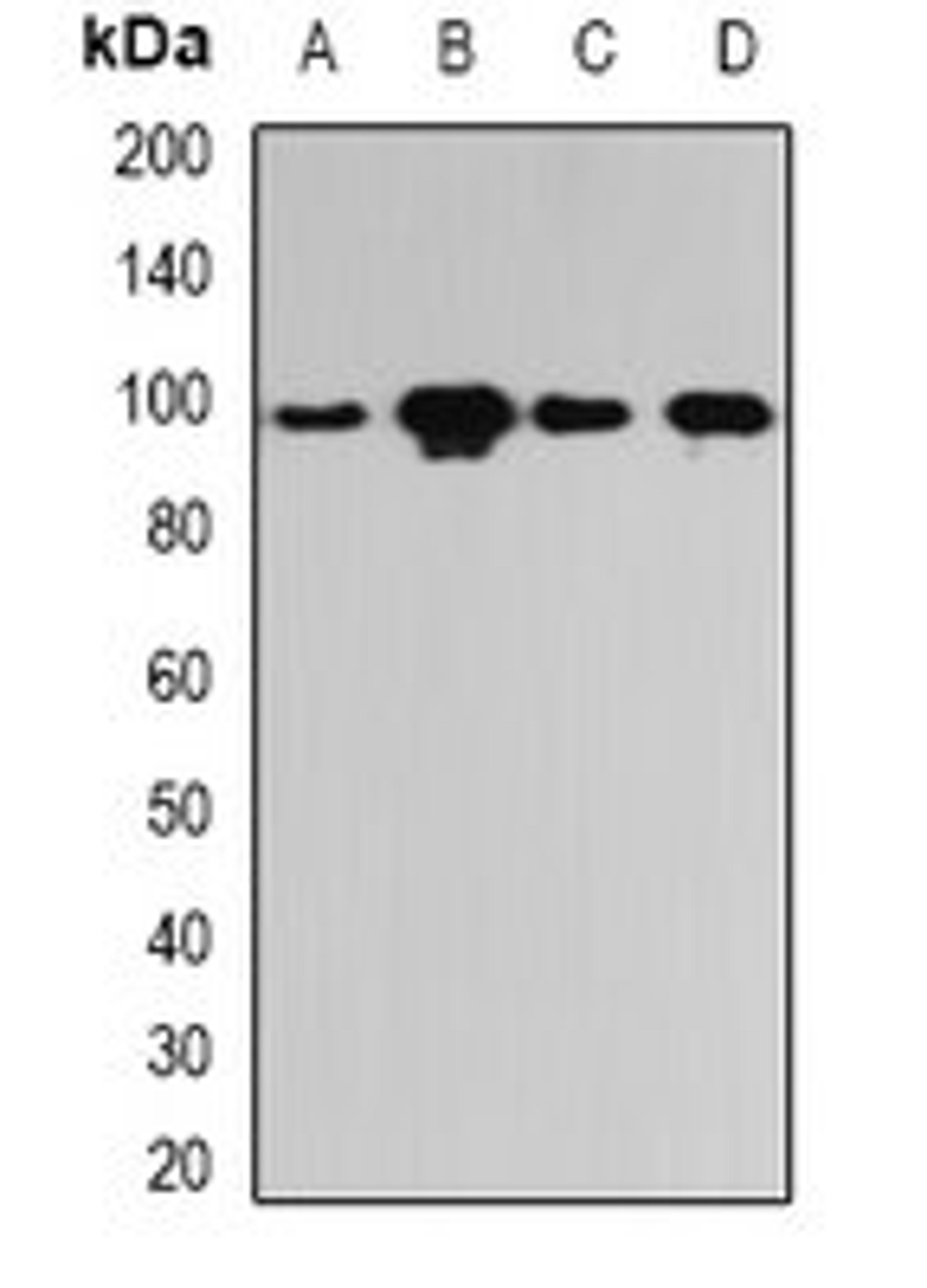 Western blot analysis of Hela (Lane1), SKOV3 (Lane2), mouse lung (Lane3), rat liver (Lane4) whole cell lysates using PYGL antibody