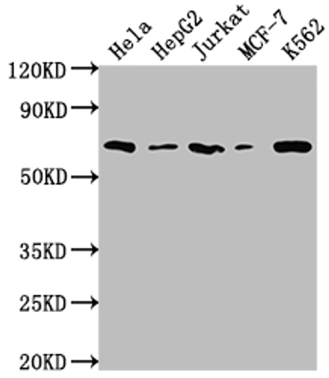 Western Blot. Positive WB detected in: Hela whole cell lysate, HepG2 whole cell lysate, Jurkat whole cell lysate, MCF-7 whole cell lysate, K562 whole cell lysate. All lanes: HDAC2 antibody at 1:2000. Secondary. Goat polyclonal to rabbit IgG at 1/50000 dilution. Predicted band size: 56, 52 kDa. Observed band size: 60 kDa. 