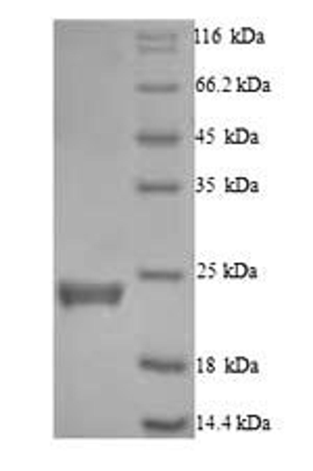 (Tris-Glycine gel) Discontinuous SDS-PAGE (reduced) with 5% enrichment gel and 15% separation gel.