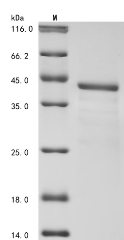(Tris-Glycine gel) Discontinuous SDS-PAGE (reduced) with 5% enrichment gel and 15% separation gel.