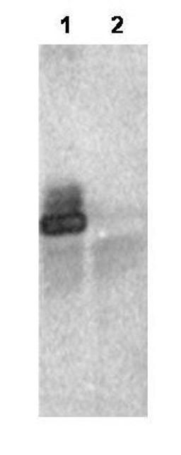 Immunoprecipitation analysis of human RNF25 (lane 1) or vector only control (lane 2) using RNF25 antibody