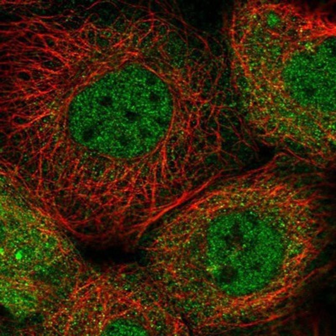 Immunocytochemistry/Immunofluorescence: CNAP1 Antibody [NBP1-88202] - Staining of human cell line A-431 shows positivity in nucleus but not nucleoli & cytoplasm.