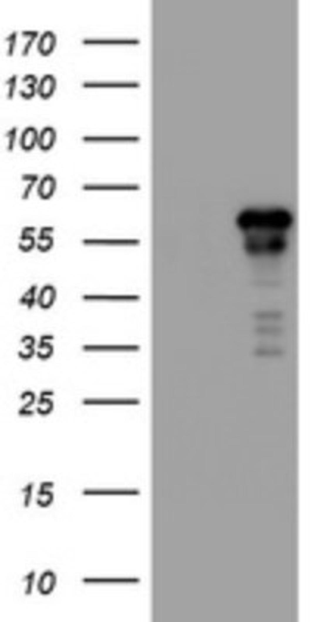 Western Blot: ACD Antibody (2B1) [NBP2-45475] - Analysis of HEK293T cells were transfected with the pCMV6-ENTRY control (Left lane) or pCMV6-ENTRY ACD.