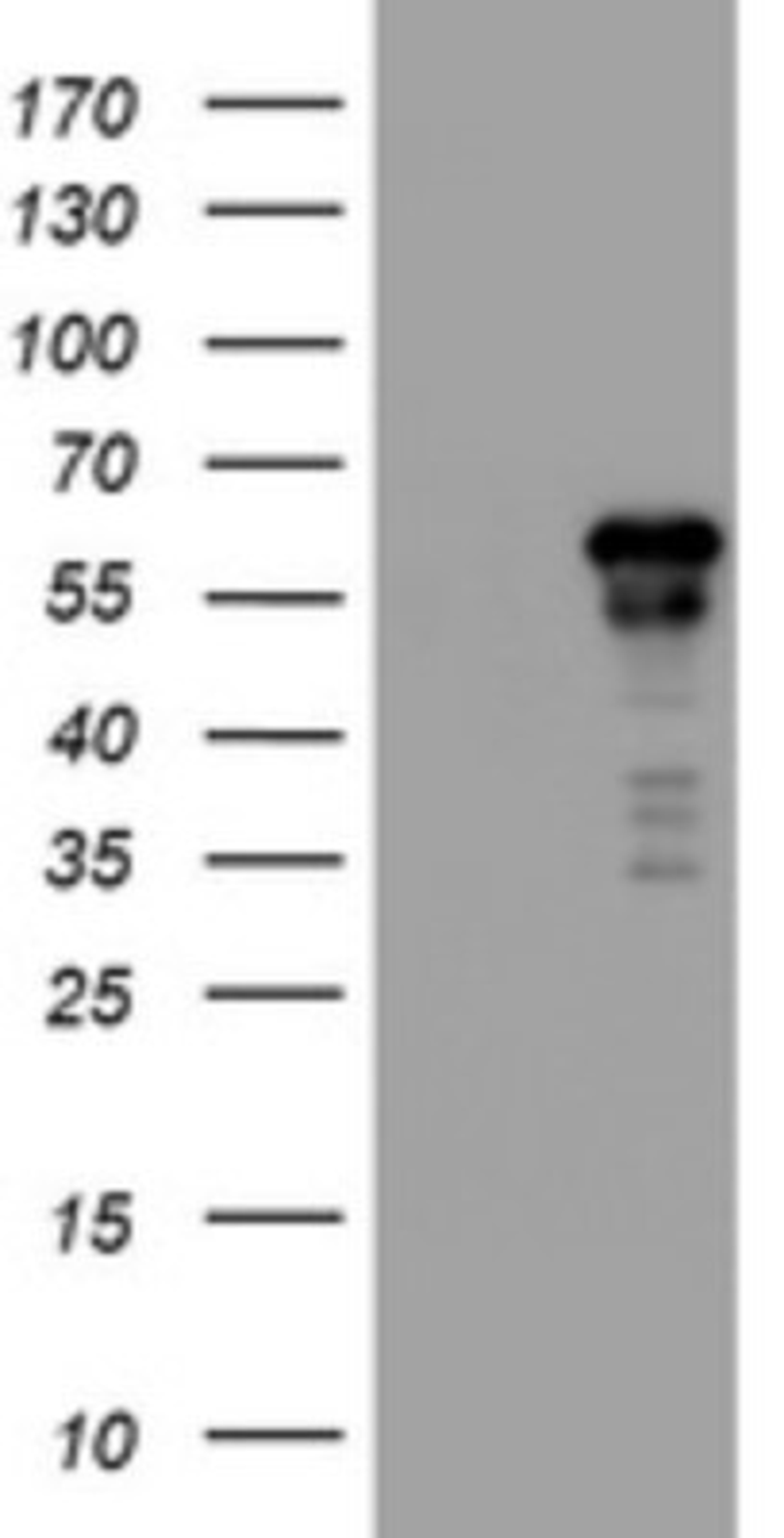 Western Blot: ACD Antibody (2B1) [NBP2-45475] - Analysis of HEK293T cells were transfected with the pCMV6-ENTRY control (Left lane) or pCMV6-ENTRY ACD.