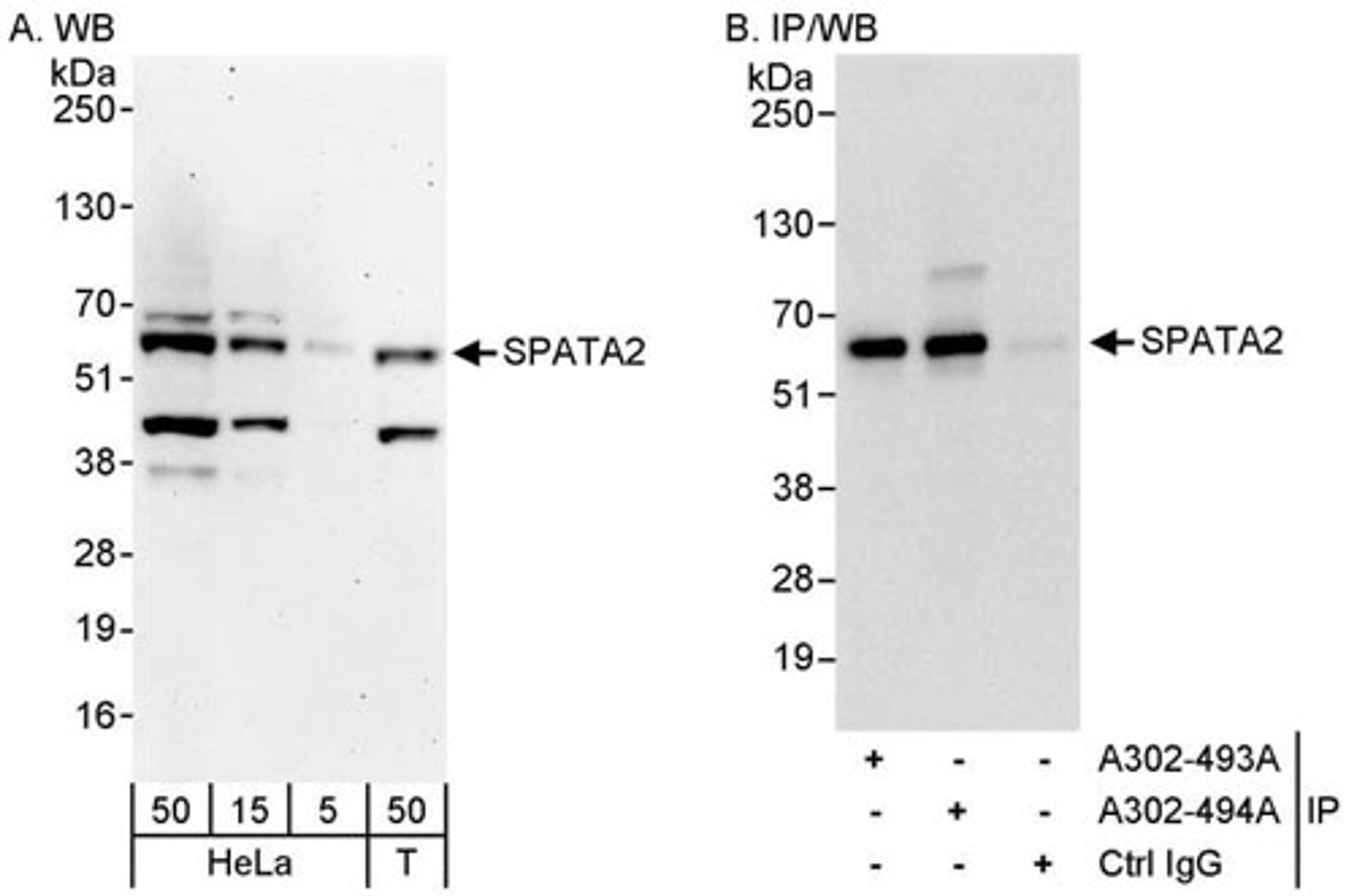 Detection of human SPATA2 by WB and IP.