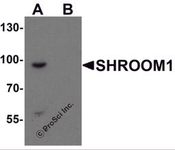 Western blot analysis of SHROOM1 in mouse heart tissue lysate with SHROOM1 antibody at 1 μg/mL in (A) the absence and (B) the presence of blocking peptide.