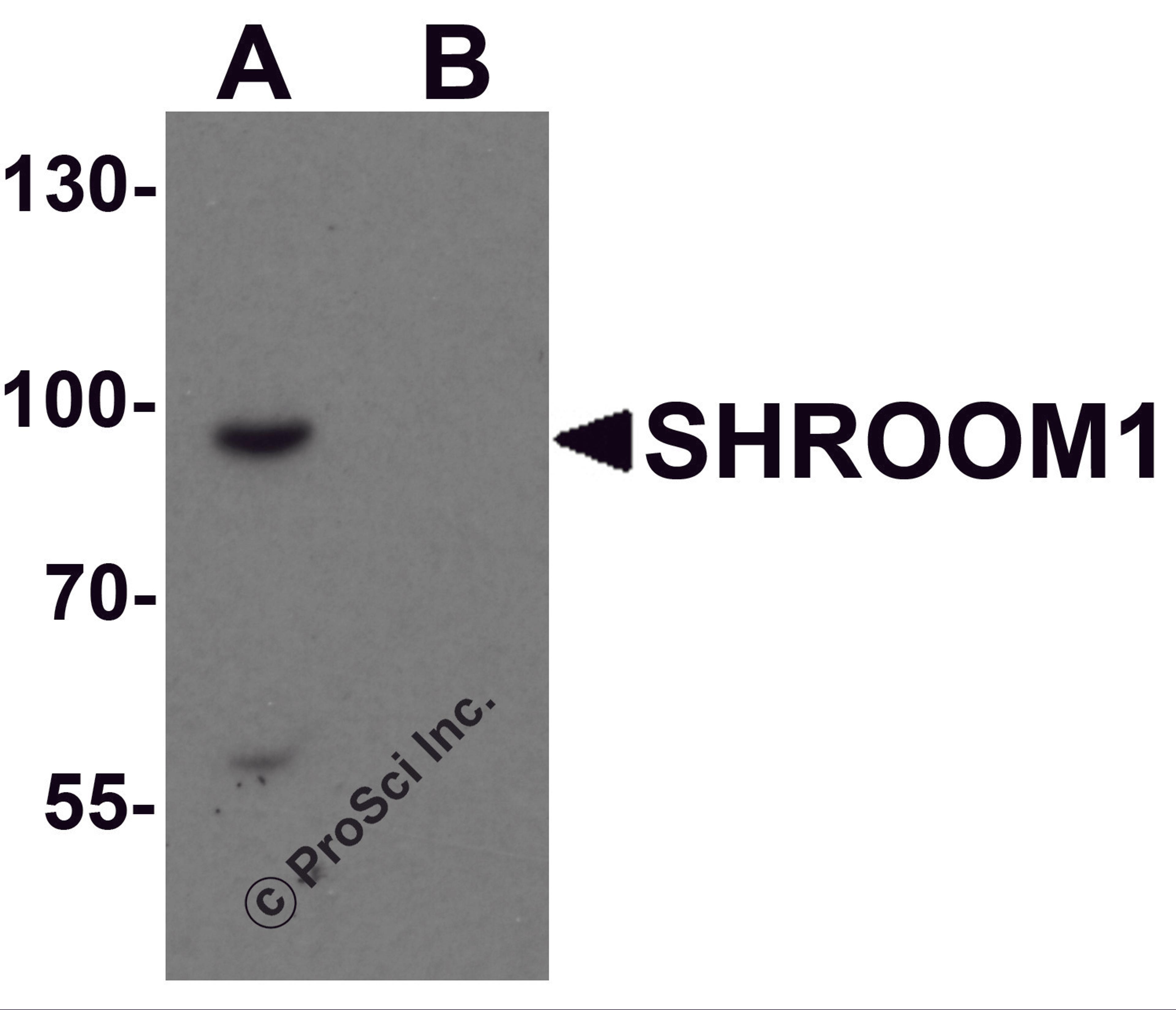Western blot analysis of SHROOM1 in mouse heart tissue lysate with SHROOM1 antibody at 1 μg/mL in (A) the absence and (B) the presence of blocking peptide.