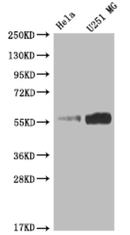 Western Blot. Positive WB detected in: Hela whole cell lysate, U251 whole cell lysate. All lanes: NUF2 antibody at 1:2000. Secondary. Goat polyclonal to rabbit IgG at 1/50000 dilution. Predicted band size: 55 kDa. Observed band size: 55 kDa.