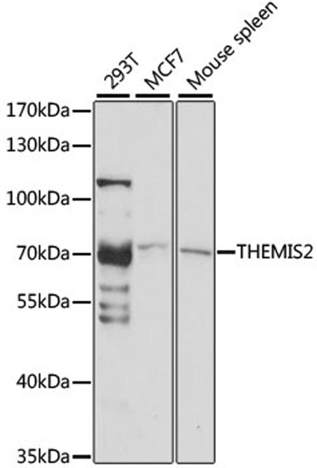 Western blot - THEMIS2 antibody (A15355)