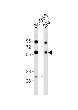 Western Blot at 1:1000 dilution Lane 1: SK-OV-3 whole cell lysate Lane 2: 293 whole cell lysate Lysates/proteins at 20 ug per lane.