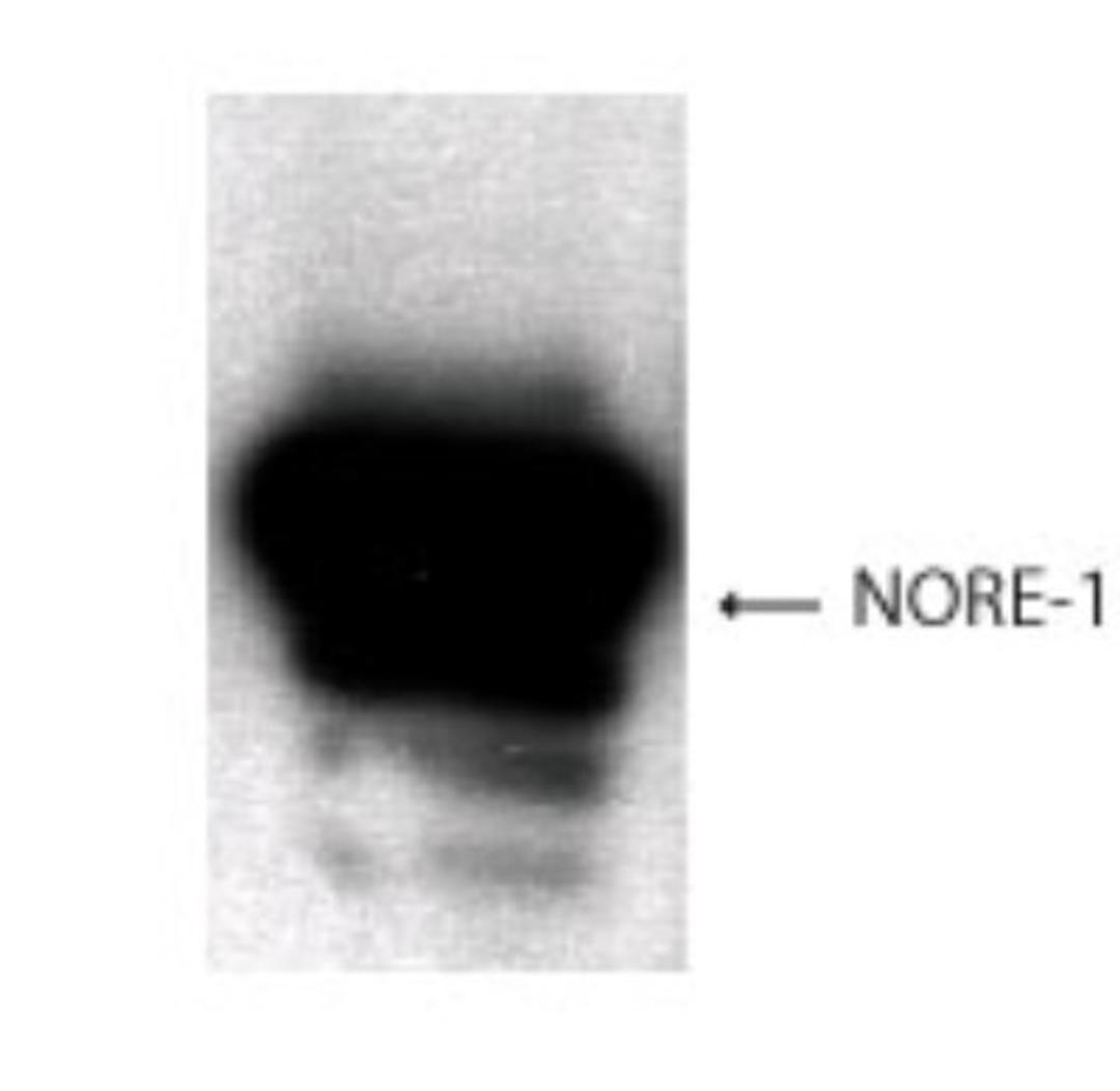 Western Blot: NORE1 Antibody [NB500-248] - Analysis of NORE1 using this antibody at 1:1000 dilution on 293 T cell lysates overexpressed with NORE1.