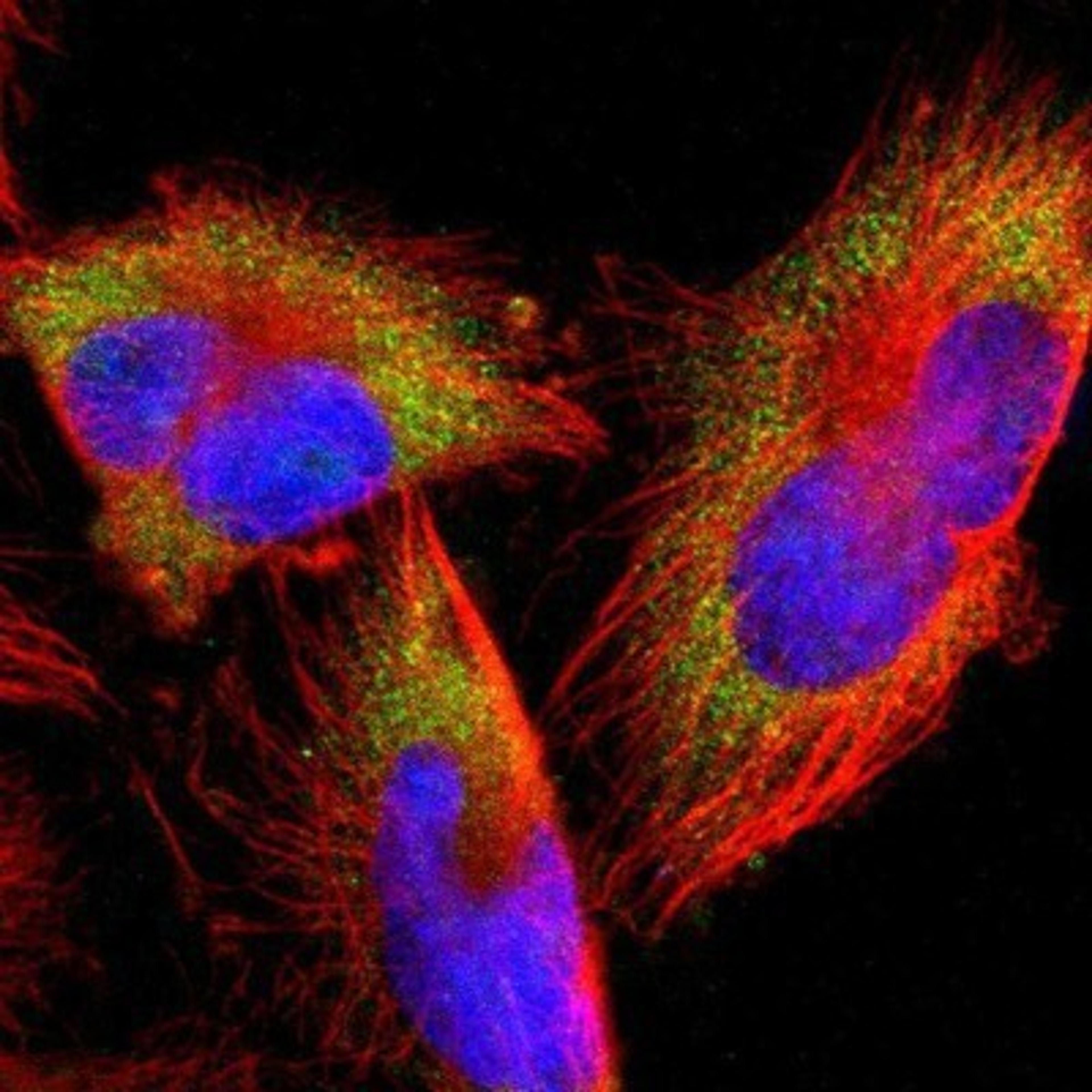 Immunocytochemistry/Immunofluorescence: 60S ribosomal protein L23 Antibody [NBP1-87847] - Staining of human cell line U-251MG shows positivity in cytoplasm.