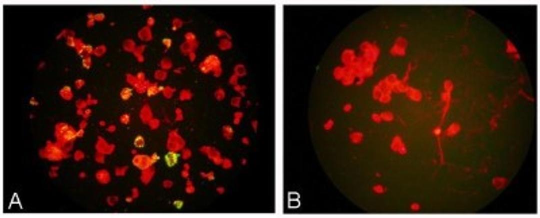 Immunocytochemistry/Immunofluorescence: Meta-Pneumovirus Antibody (HMPV123) [NBP1-21631] - A Newcastle strain of HMPV grown on LLC MK cells and non infected cells stained with Mouse anti Metapneumovirus, NBP1-21631, and counterstained with Evans Blue.