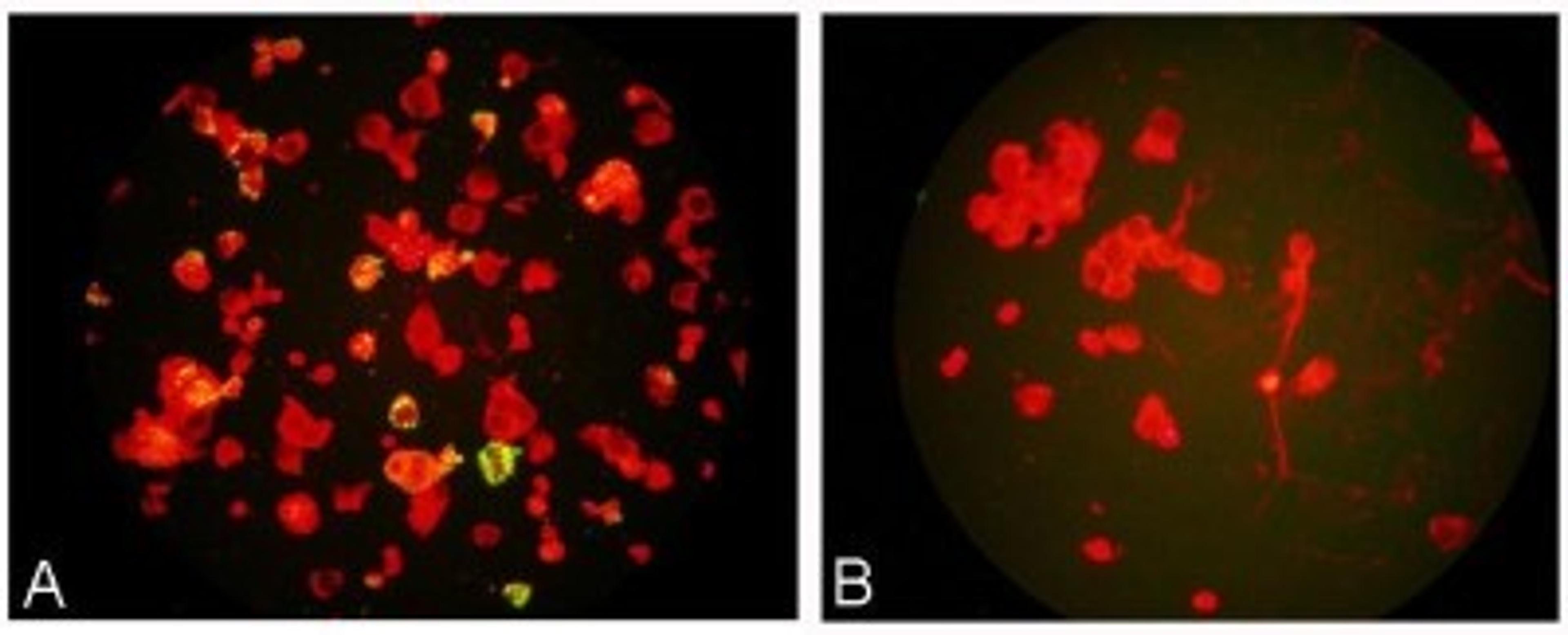 Immunocytochemistry/Immunofluorescence: Meta-Pneumovirus Antibody (HMPV123) [NBP1-21631] - A Newcastle strain of HMPV grown on LLC MK cells and non infected cells stained with Mouse anti Metapneumovirus, NBP1-21631, and counterstained with Evans Blue.