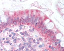 Immunohistochemistry: Niemann-Pick type C1 Like-1 Antibody [NB400-128] - Staining of small intestine, enterocytes.