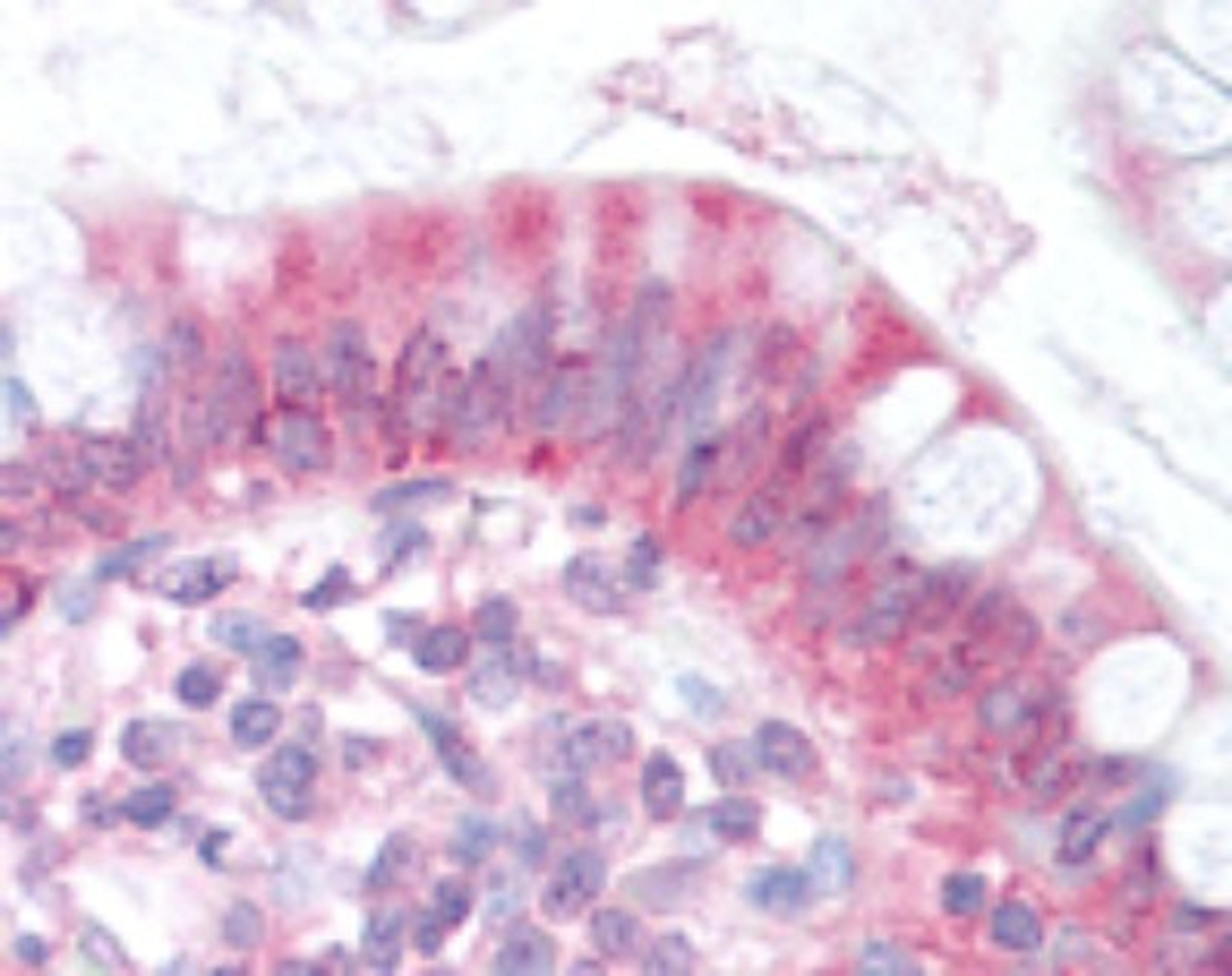 Immunohistochemistry: Niemann-Pick type C1 Like-1 Antibody [NB400-128] - Staining of small intestine, enterocytes.