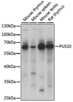 Western blot - PUS10 antibody (A15962)