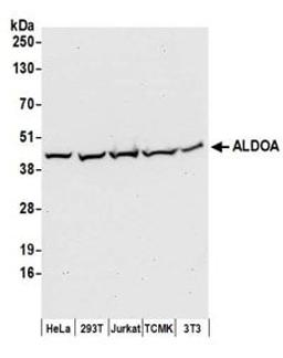 Detection of human and mouse ALDOA by western blot.