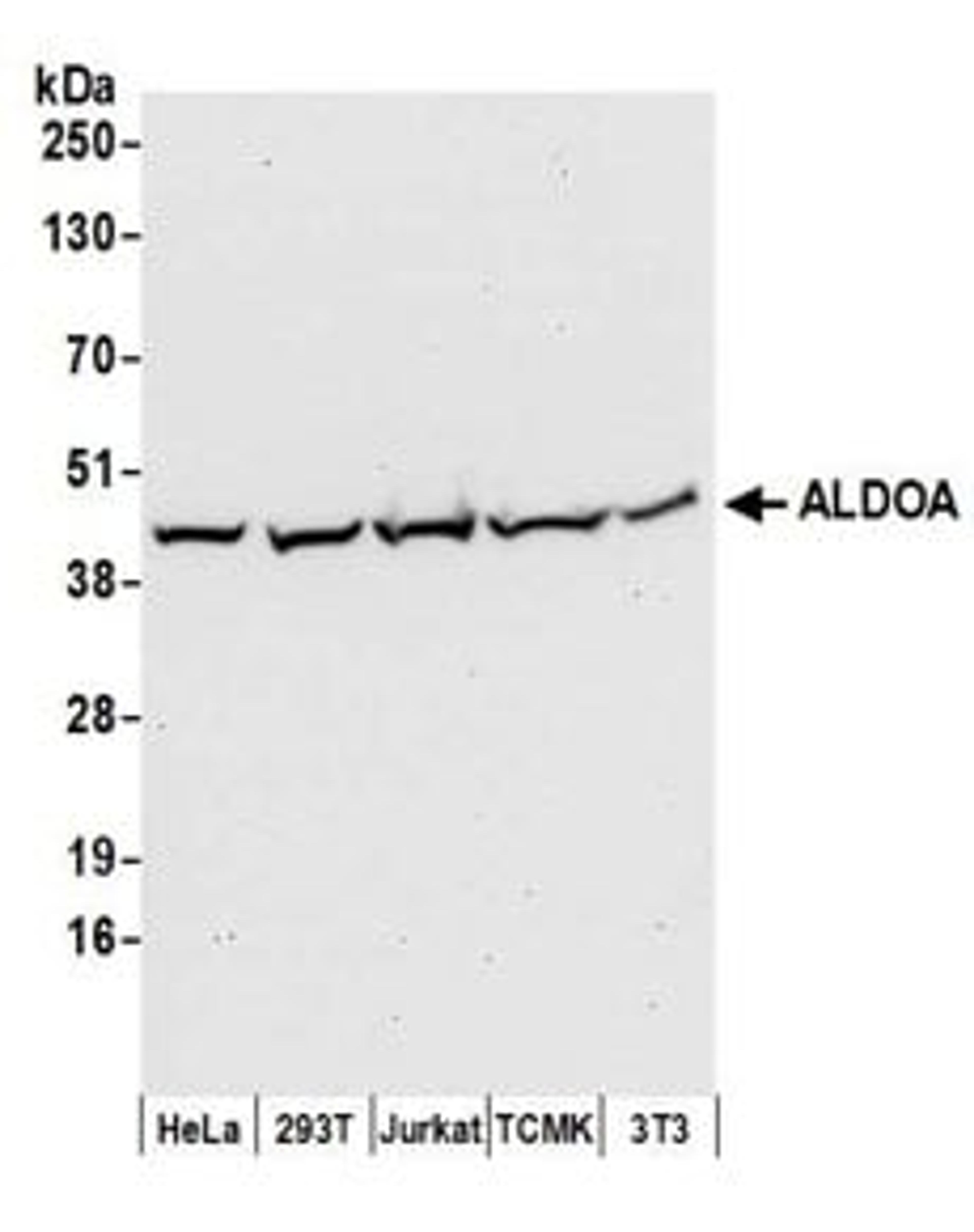 Detection of human and mouse ALDOA by western blot.