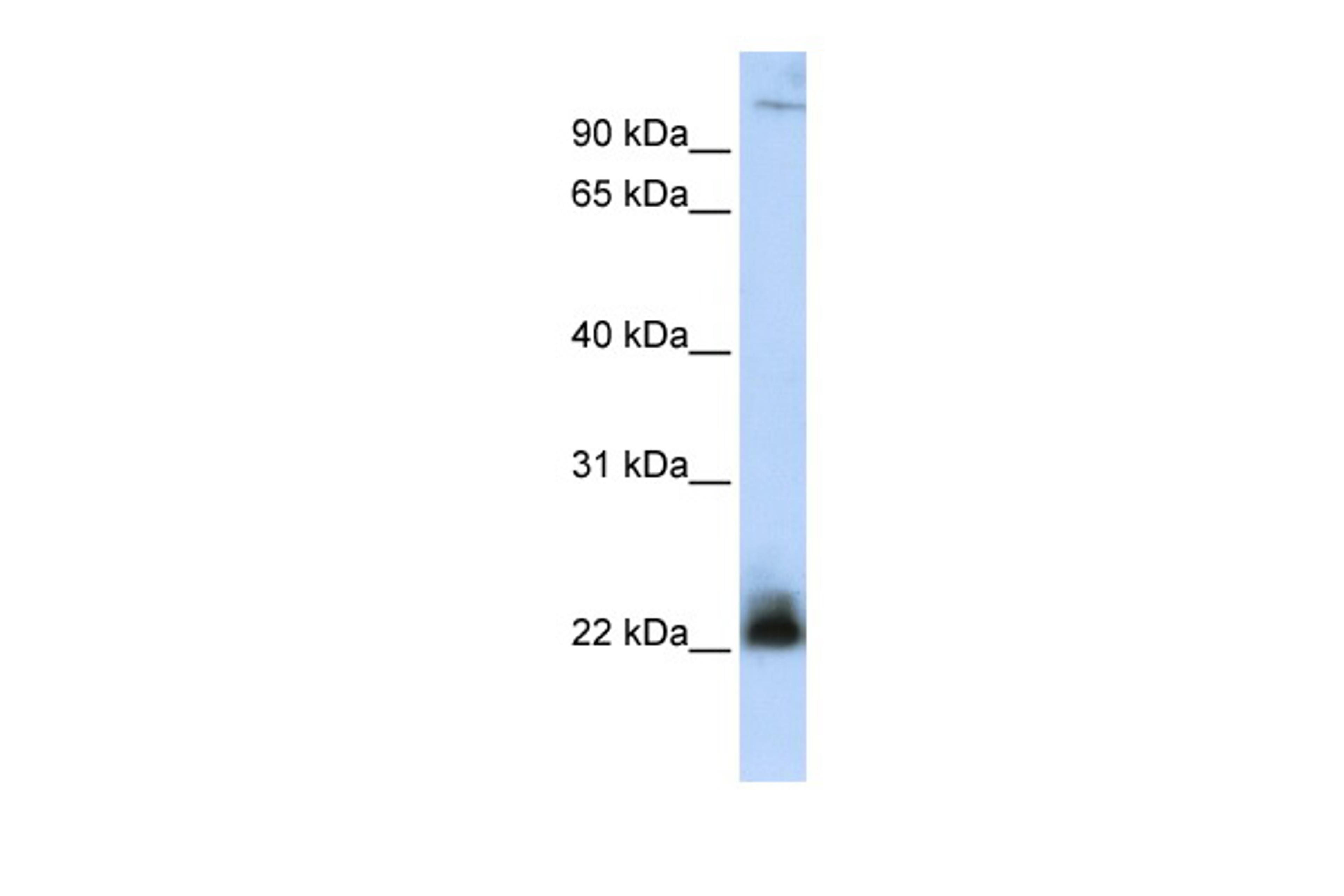 Antibody used in WB on Human MCF-7 at 0.2-1 ug/ml.