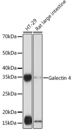 Western blot - Galectin 4 Rabbit mAb (A3691)