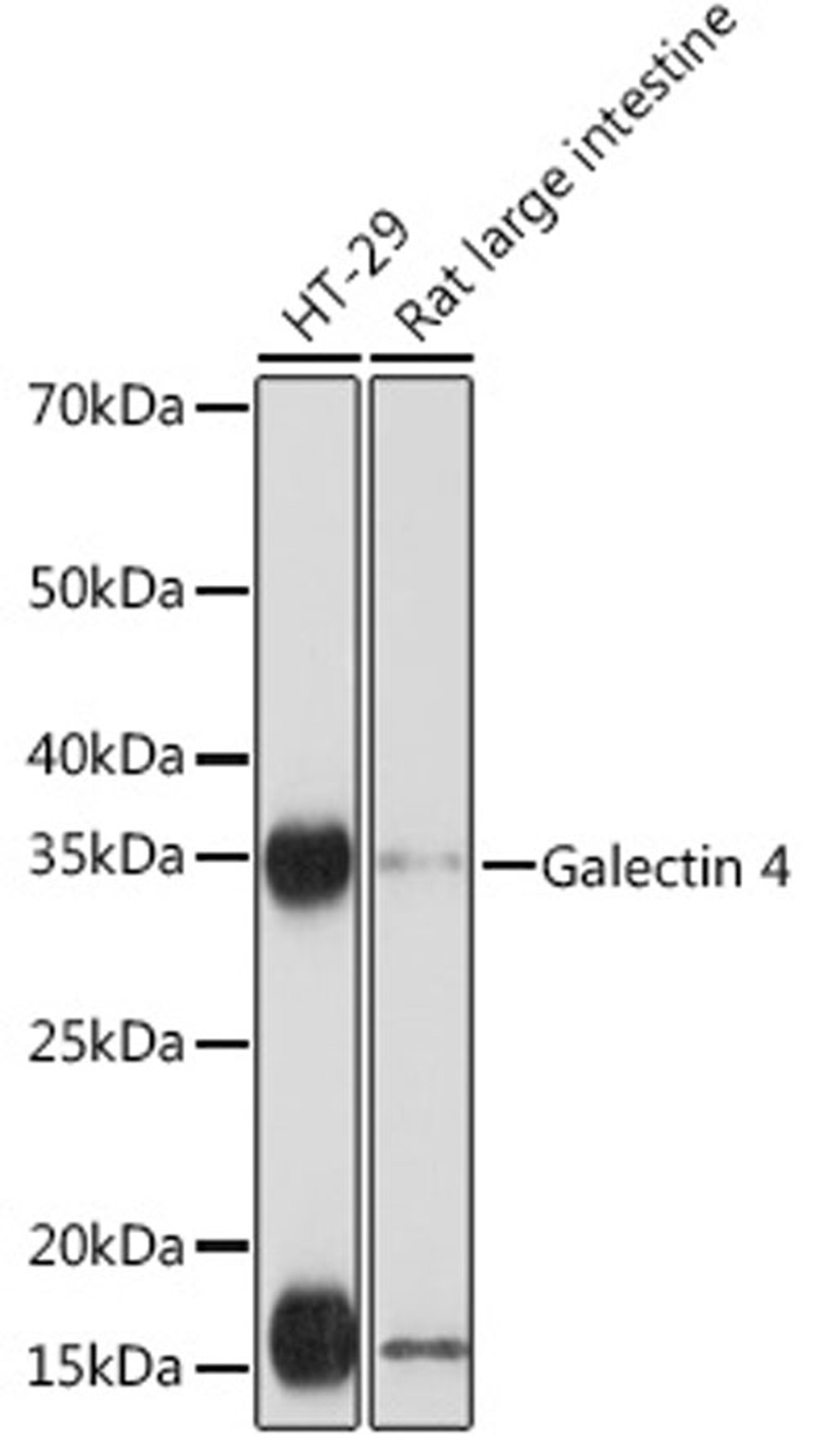 Western blot - Galectin 4 Rabbit mAb (A3691)