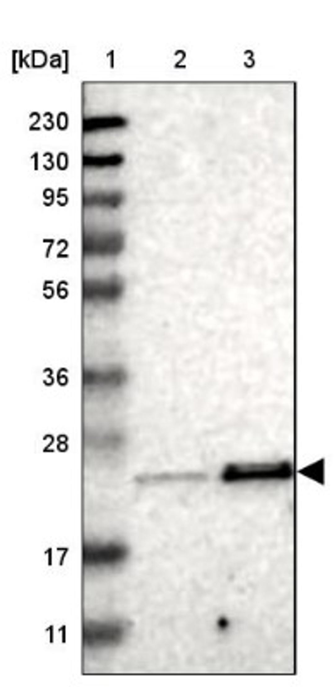 Western Blot: TEX261 Antibody [NBP1-81126] - Lane 1: Marker [kDa] 230, 130, 95, 72, 56, 36, 28, 17, 11<br/>Lane 2: Human cell line RT-4<br/>Lane 3: Human cell line U-251MG sp