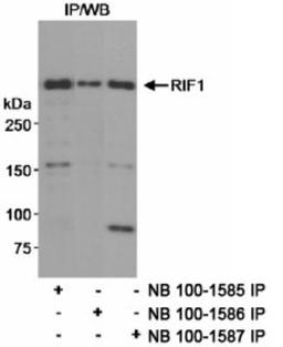 Immunoprecipitation: Rif1 Antibody [NB100-1585] - Detection of Human RIF1 on HeLa whole cell lysate using NB100-1585. RIF1 was also immunoprecipitated using rabbit anti-RIF1 antibodies NB100-1586 and NB100-1587.