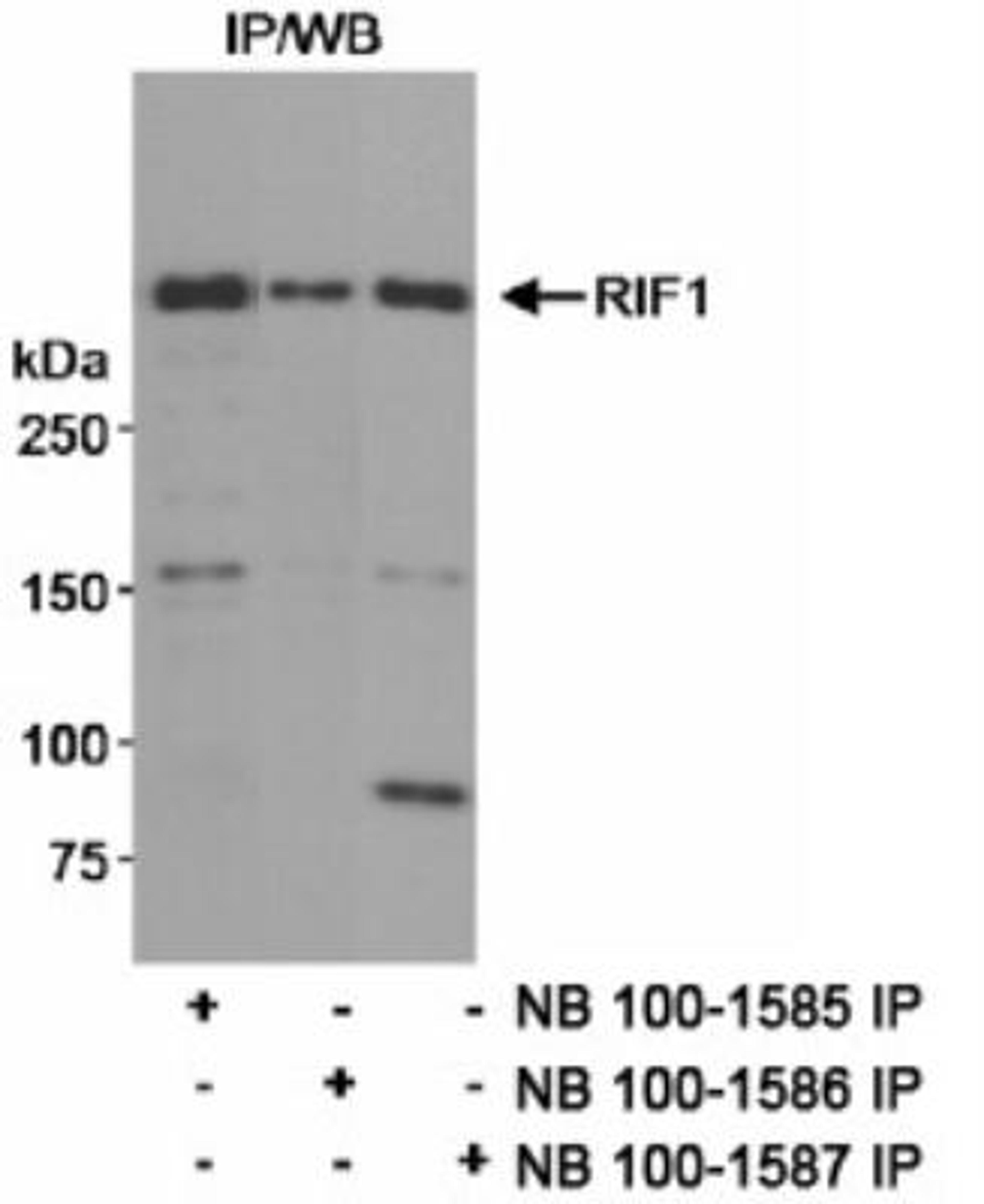 Immunoprecipitation: Rif1 Antibody [NB100-1585] - Detection of Human RIF1 on HeLa whole cell lysate using NB100-1585. RIF1 was also immunoprecipitated using rabbit anti-RIF1 antibodies NB100-1586 and NB100-1587.