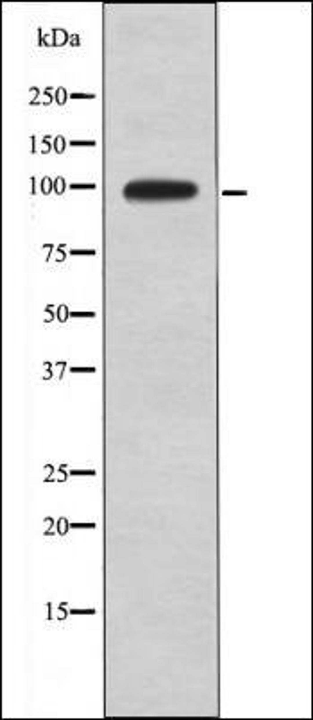 Western blot analysis of UV treated HeLa whole cell lysates using DAG1 -Phospho-Tyr892- antibody