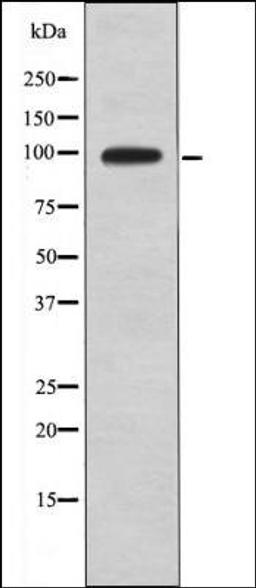 Western blot analysis of UV treated HeLa whole cell lysates using DAG1 -Phospho-Tyr892- antibody