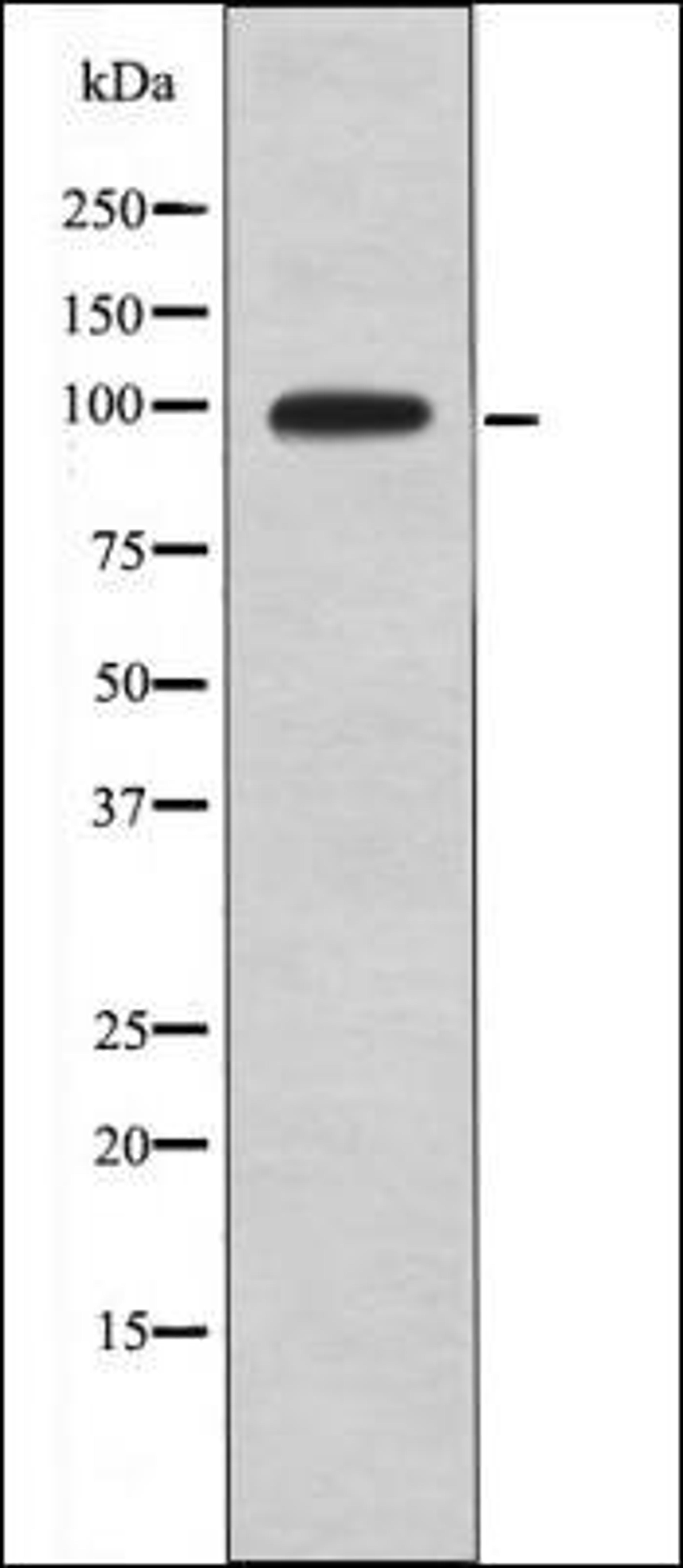 Western blot analysis of UV treated HeLa whole cell lysates using DAG1 -Phospho-Tyr892- antibody