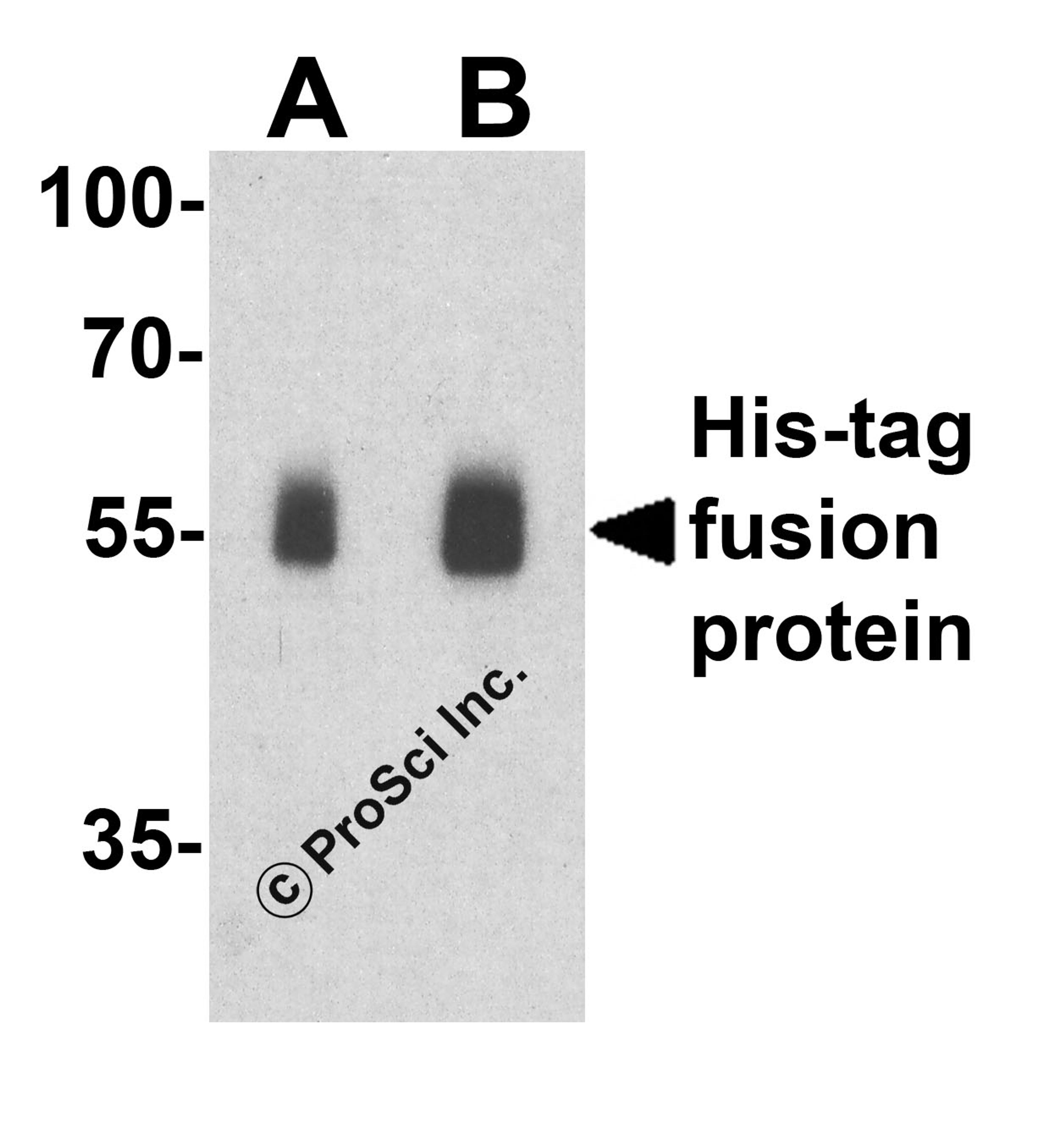 Western blot analysis of a His-tag-containing recombinant protein with His-tag antibody at (A) 0.25 and (B) 0.5 μg/ml.