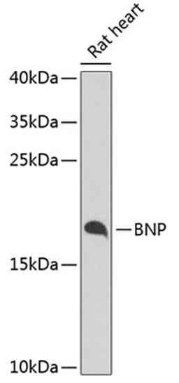 Western blot - BNP antibody (A2179)