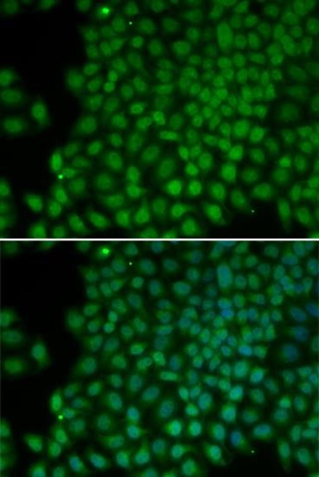 Immunofluorescense analysis of hela cell using POLR1C antibody