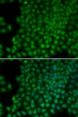 Immunofluorescense analysis of hela cell using POLR1C antibody