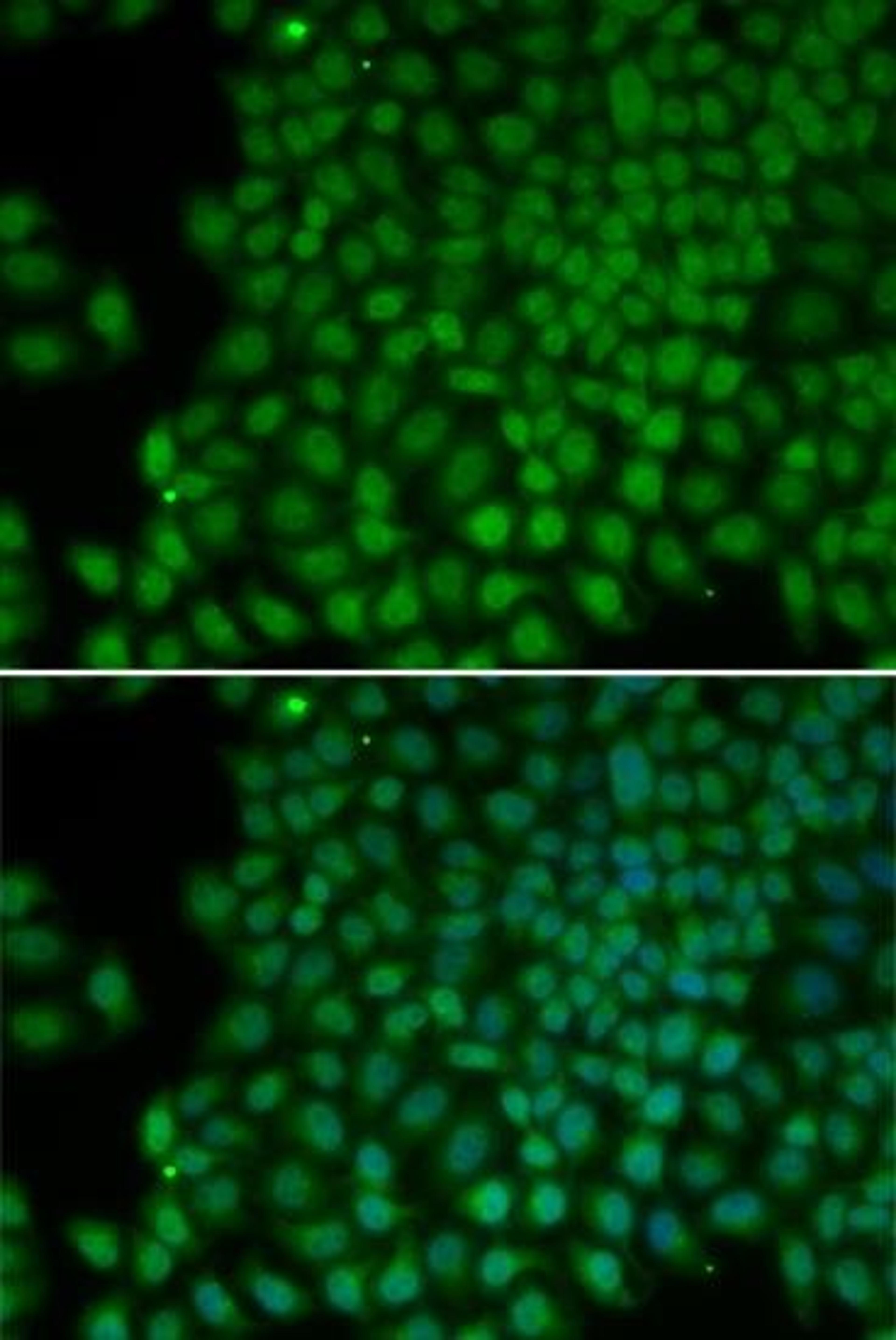 Immunofluorescense analysis of hela cell using POLR1C antibody