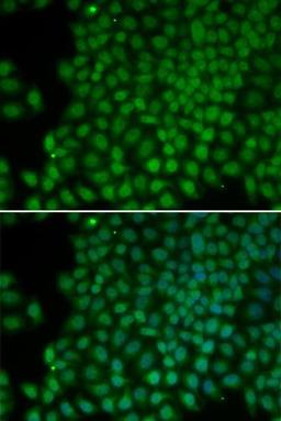 Immunofluorescense analysis of hela cell using POLR1C antibody