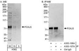 Detection of human FOXJ3 by western blot and immunoprecipitation.