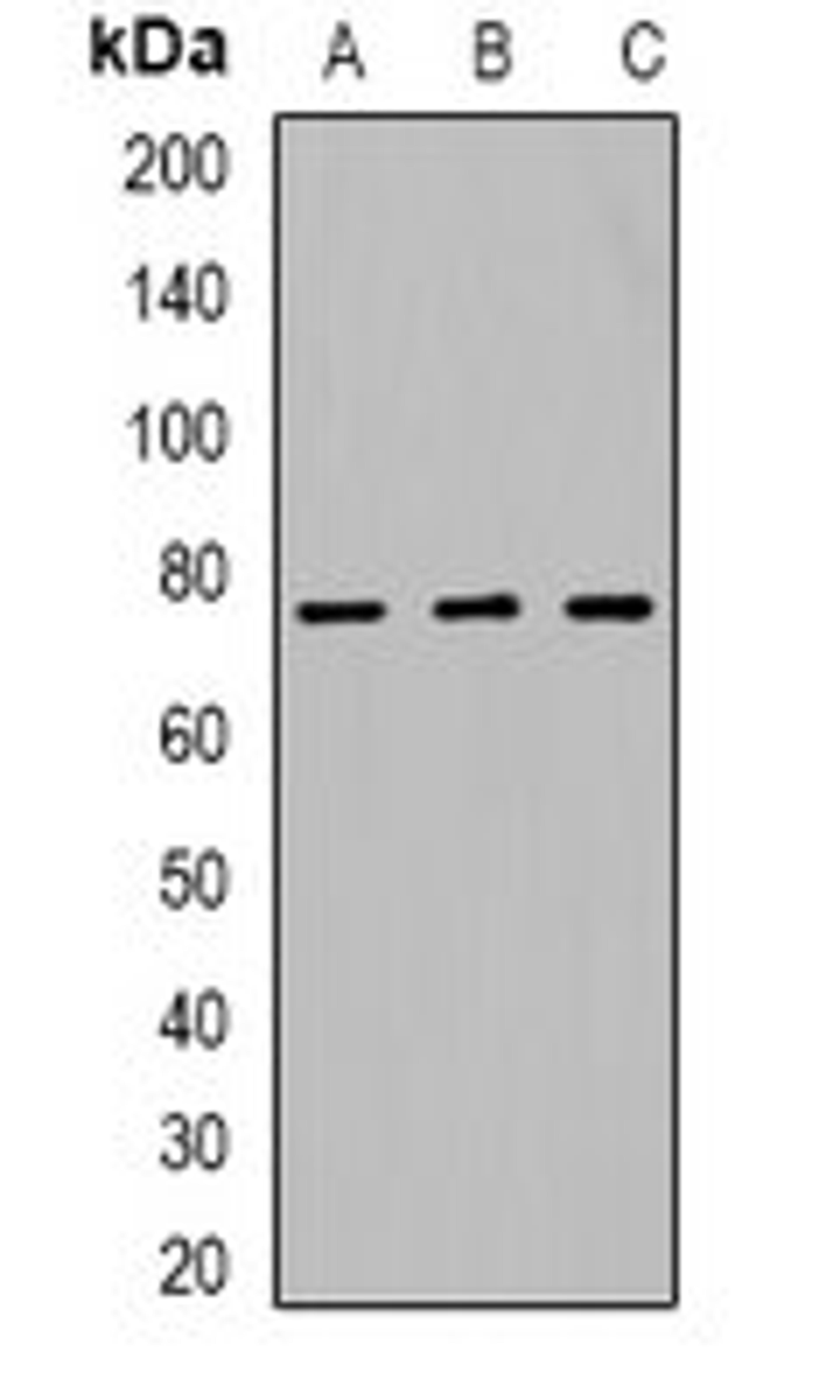 Western blot analysis of HEK293T (Lane1), NIH3T3 (Lane2), PC12 (Lane3) whole cell lysates using SETMAR antibody