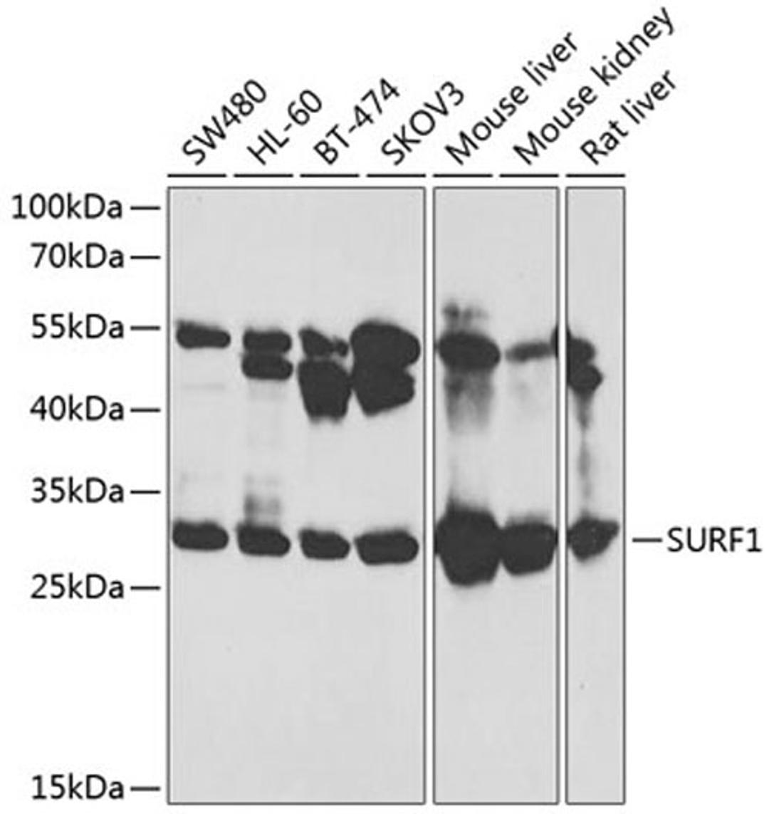 Western blot - SURF1 antibody (A12521)