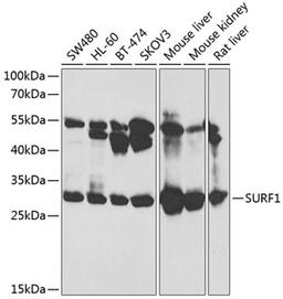 Western blot - SURF1 antibody (A12521)