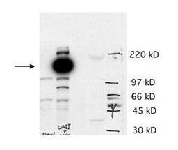 Western blot analysis of Lane 1 contains a lysate from AS cells transfected with empty vector. Lane 2 contains lysate from AS cells transfected with hCas5 (predicted MW 125 kDa). Lane 3 contains lysate from BE2 cells using Cas5 antibody